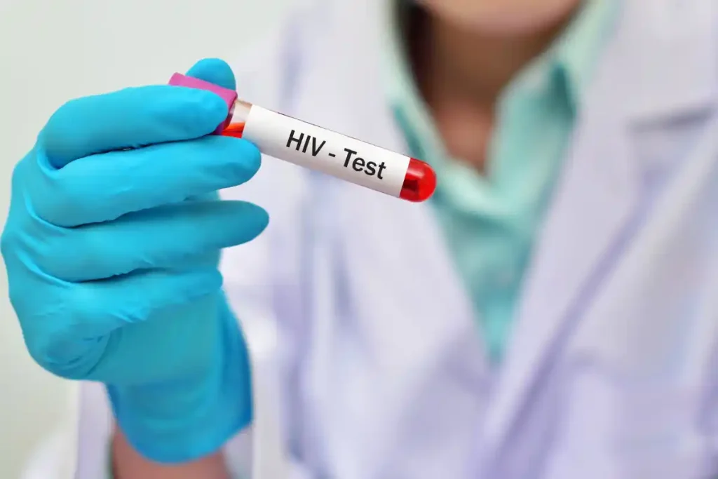 Medico con guanti protettivi tiene una provetta di sangue etichettata HIV Test per lo screening delle malattie sessualmente trasmissibili.